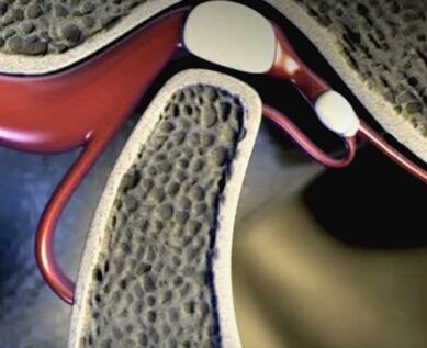 TMJ structural representation